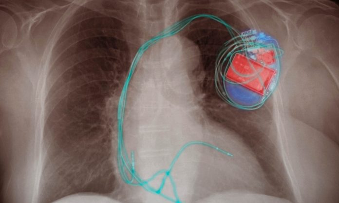 New nano-material for self-powered electronics